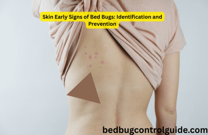 Skin Early Signs of Bed Bugs: Identification and Prevention