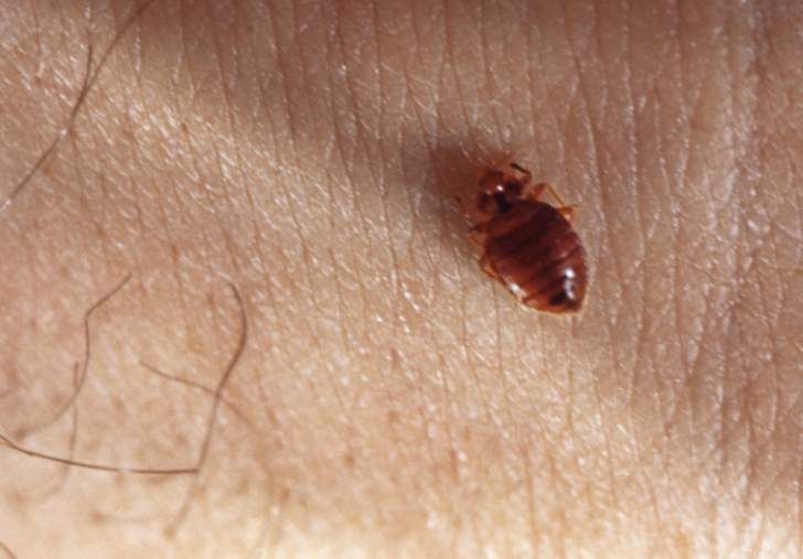 What Are the Skin Early Signs of Bed Bugs? Pest Control Guides