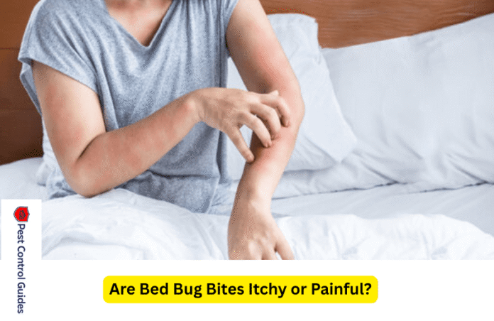 Are Bed Bug Bites Itchy or Painful? Pest Control Guides